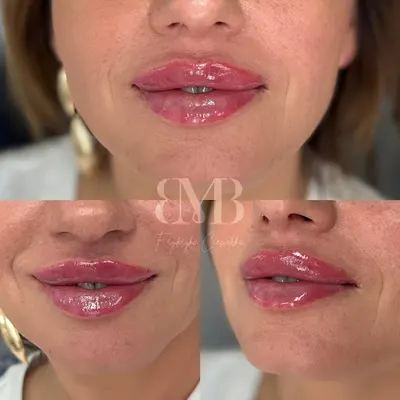 Bling Medical & Beauty Fryderyka Ciesielska